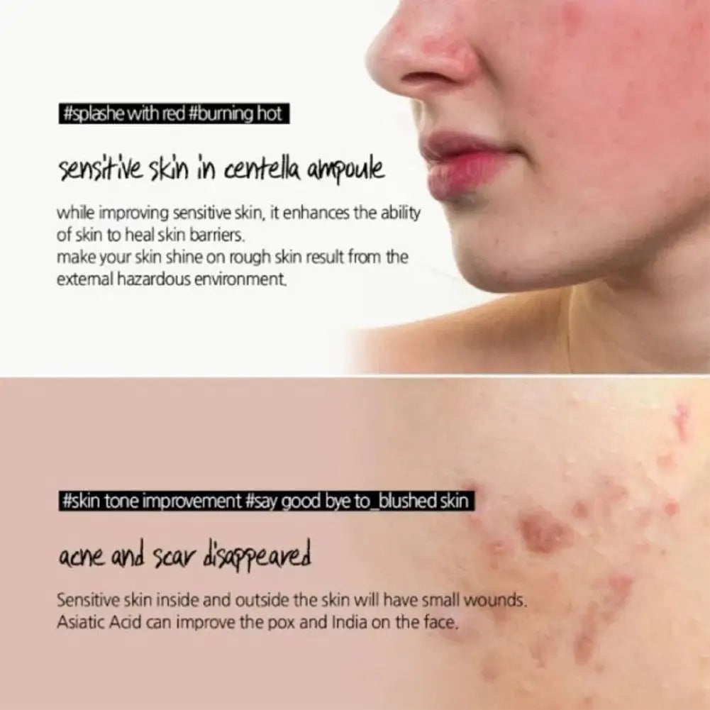 50/100ML Centella Asiatica Moisturizing Essence Moisturizing Water Repair Relieve Acne Brighten Skin Wrinkle Removal Anti-Aging