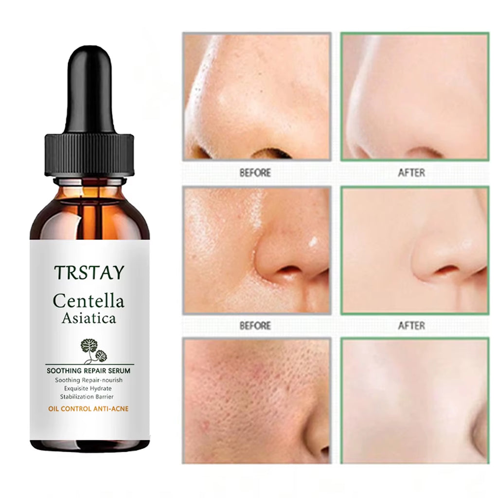 Centella Asiatica SOOTHING REPAIR SERUM Mild Improvement of Dryness, Soft and Smooth Skin