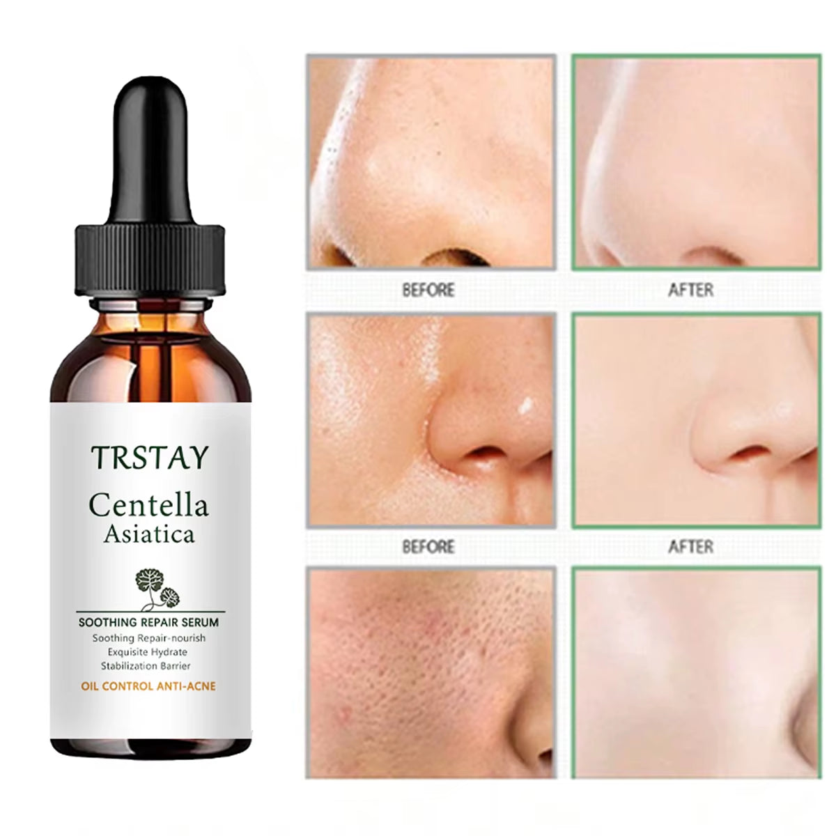 Centella Asiatica SOOTHING REPAIR SERUM Mild Improvement of Dryness, Soft and Smooth Skin
