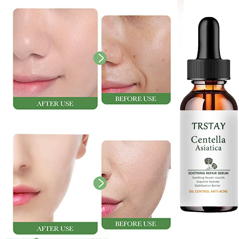Centella Asiatica SOOTHING REPAIR SERUM Mild Improvement of Dryness, Soft and Smooth Skin